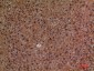 CD276 Polyclonal Antibody